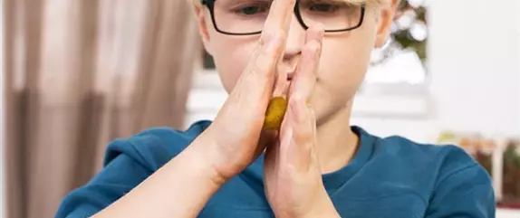 Filzeicheln in vielen Farben!